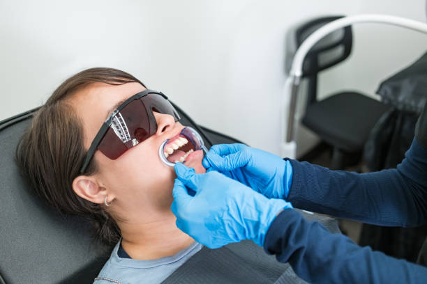 Best Teeth Whitening  in Gueydan, LA